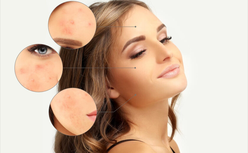 1-dermatologia-marina-conese