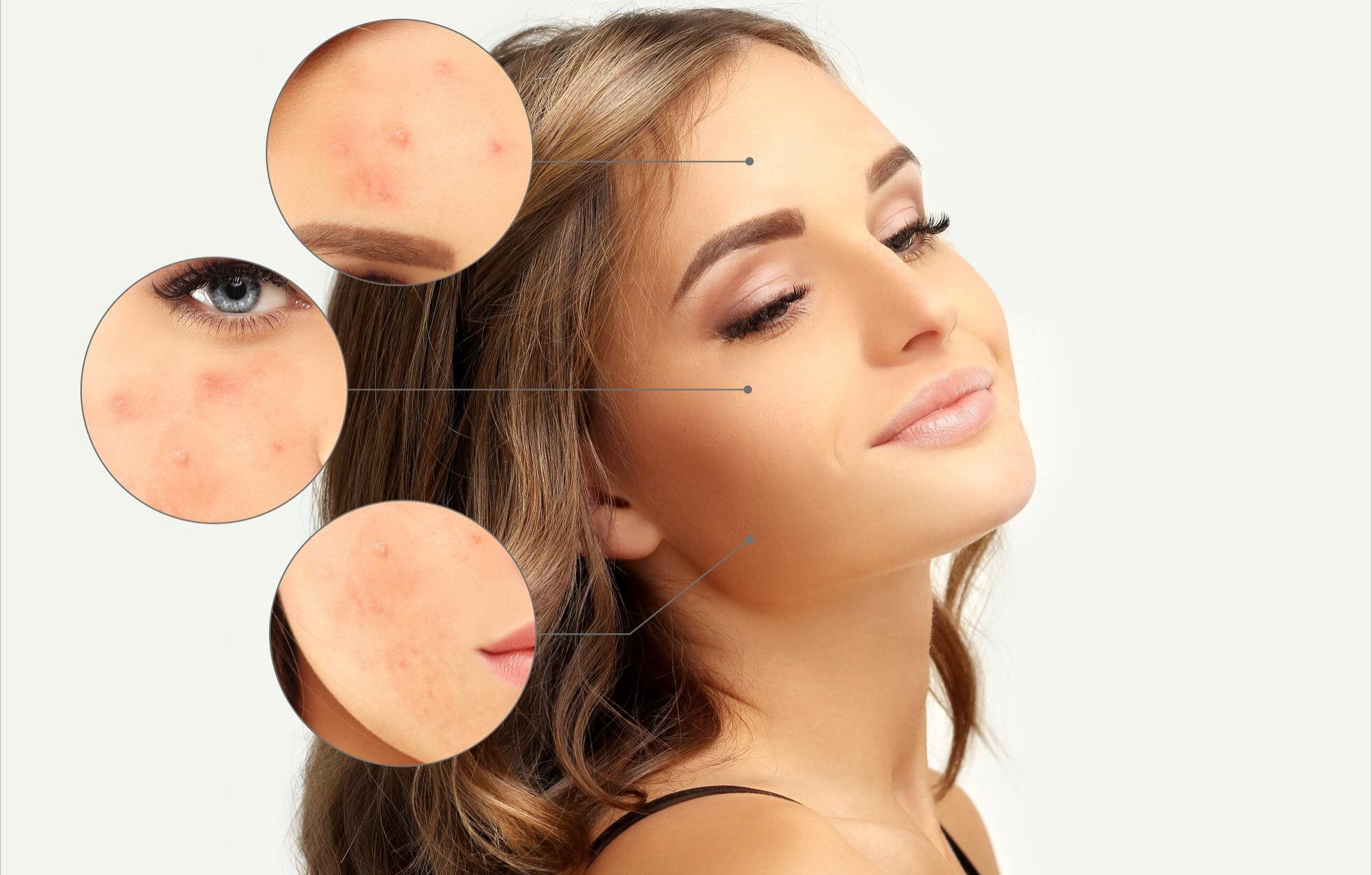 1-dermatologia-marina-conese