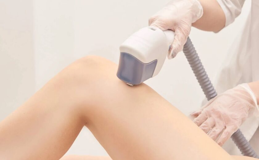 2-marina-conese-dermatologa-epilazione