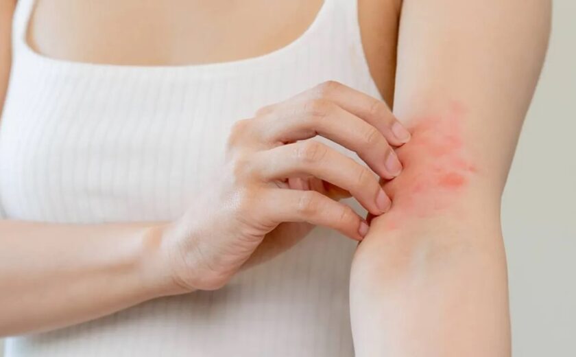 6-dermatologia-acne-eczema-psoriasi-trattamenti-dermatologici-pelle-marina-conese